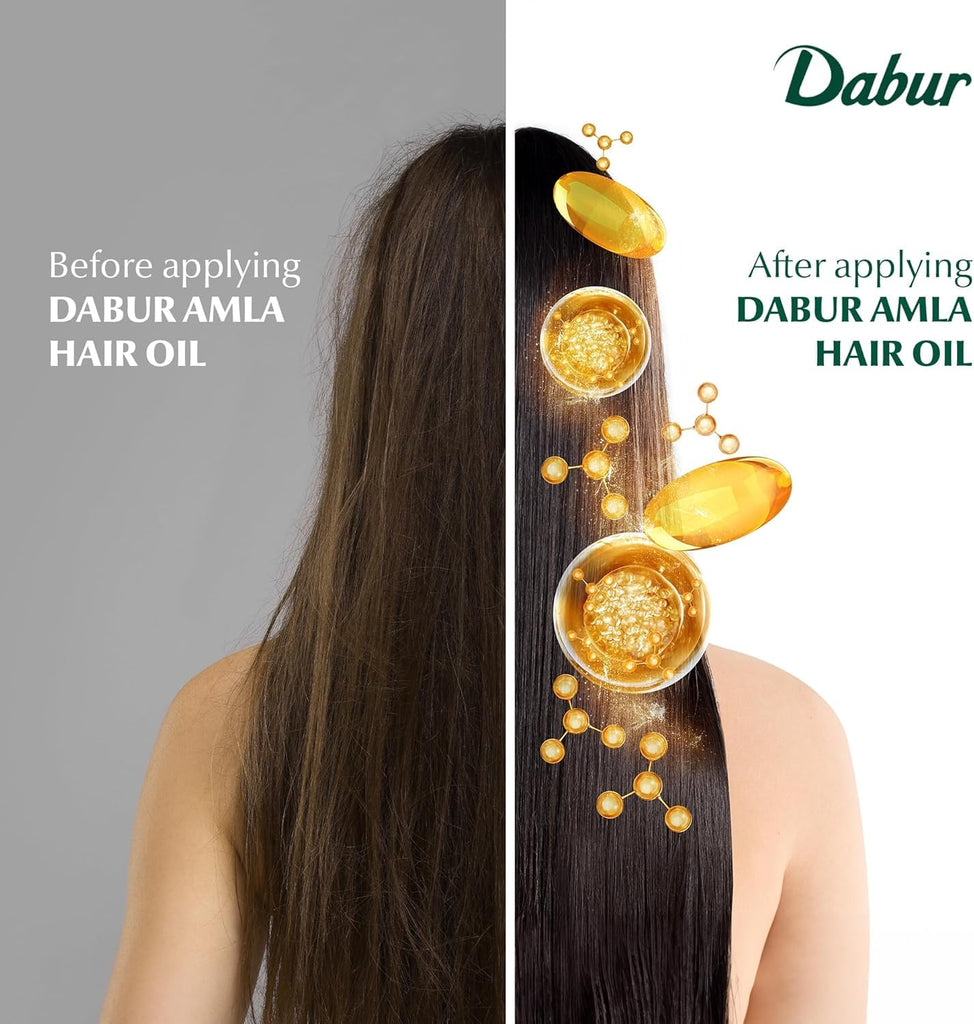 Dabur Amla Natural Hair Oil - 10.14 oz